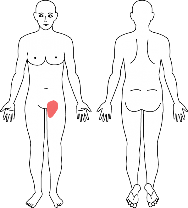 部 が 痛い 鼠蹊 鼠径部痛症候群(股関節の痛み)の治療