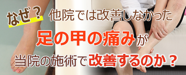 なぜ？他院では改善しなかった足の甲の痛みが当院の施術で改善するのか？