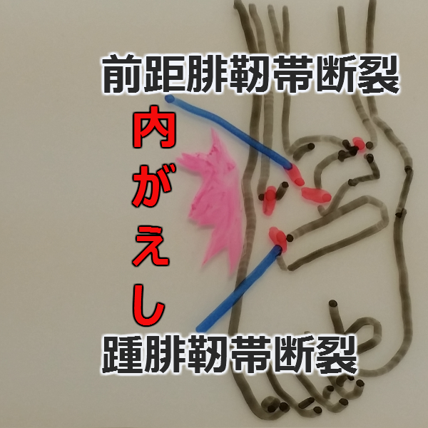 内反捻挫